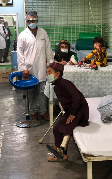 A boy with a prosthetic leg sits on a bed.